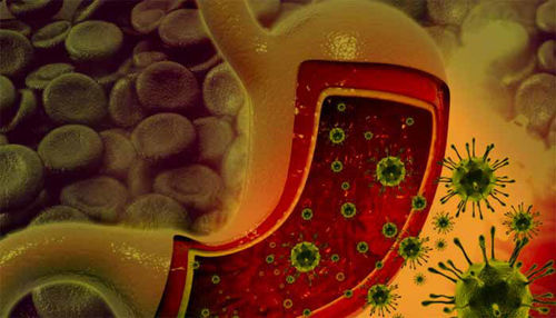 Gastroenteritis